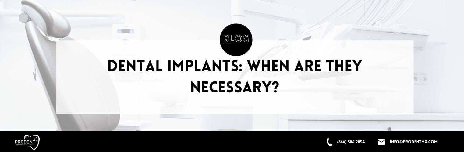 Dental implants When are they necessary
