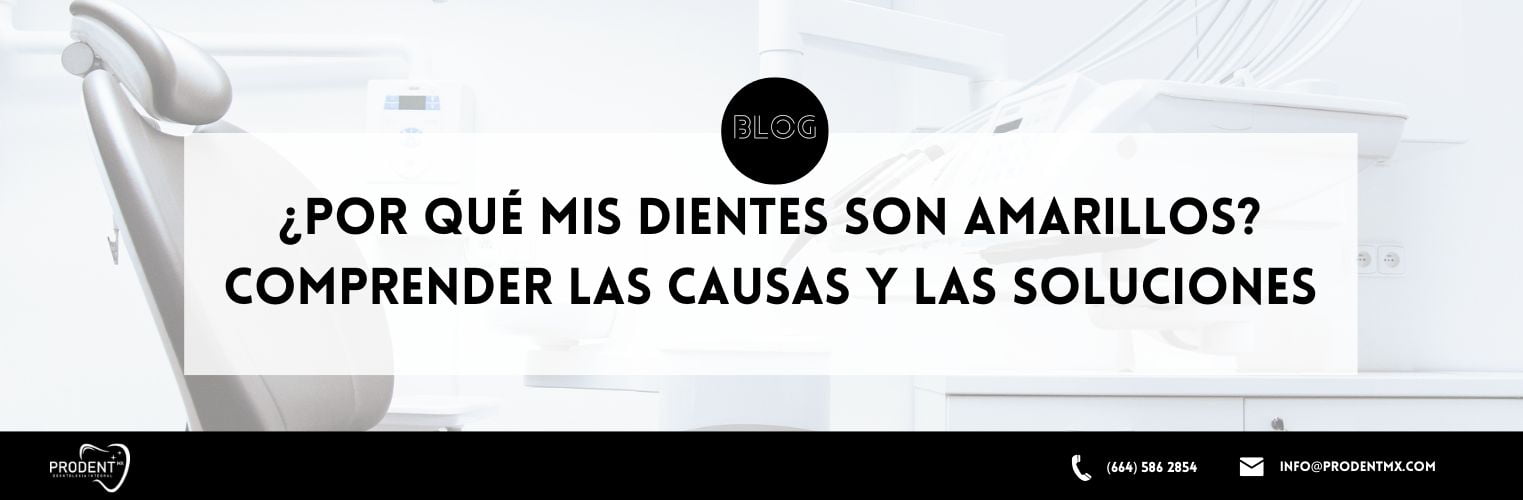 Por qué mis dientes son amarillos Comprender las causas y las soluciones